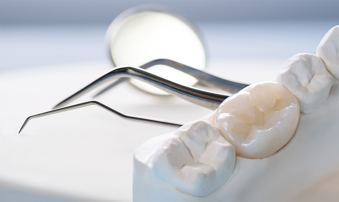 [DENT7213] Advanced Clinical Dentistry IB (Herston). Semester 1, 2025 DENT7213