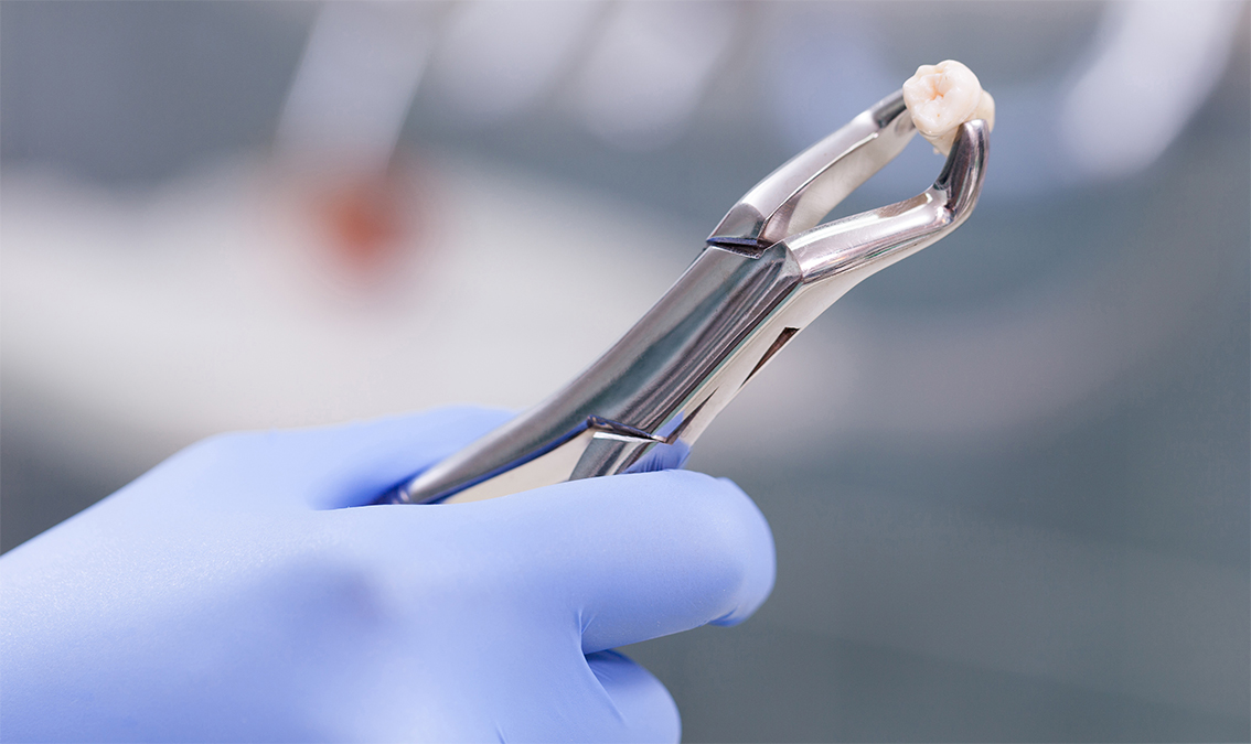 [DENT7214] Clinical Dentistry IB (Herston). Semester 1, 2025 DENT7214