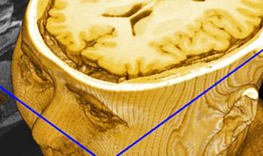 Introduction to Biomedical Imaging BIOIMG101x